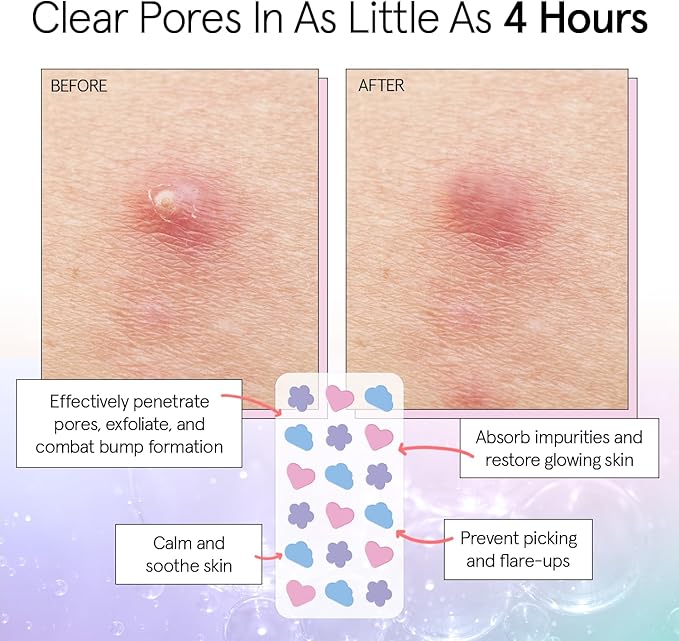 grace & stella Award Winning Hydrocolloid Patches with Salicylic Acid (Multishape, 36 Count) - Covers with Tea Tree - Patches for Impurities - Dermatologist Tested Skin Care, Cruelty Free, Vegan - Image 2